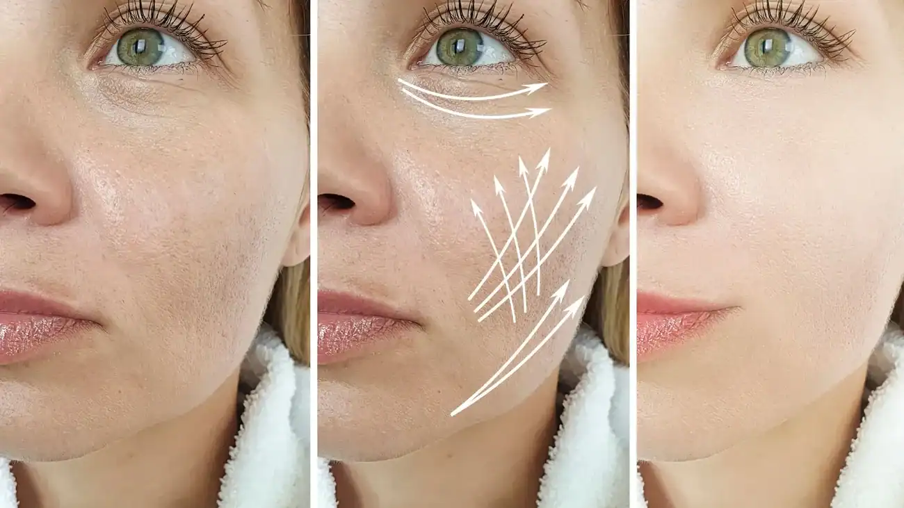 Can One Treatment Really Tackle More Than One Skin Concern Woburn Sands?