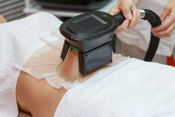 Image of person having fat freezing treatment to help weight gain Woburn Sands