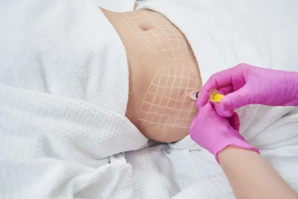 image of fat dissolving injections on love handles to help combat weight gain Woburn Sands