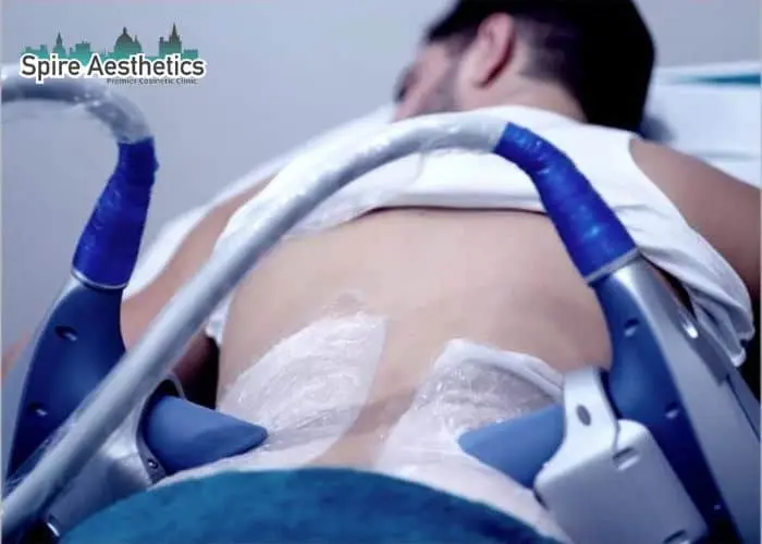 Man having fat freezing treatment done on love handles before a competitions Woburn Sands to create a sculpted look.