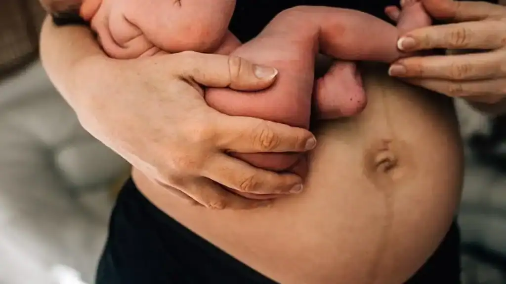 Why Is My Stomach Still Big After Pregnancy Woburn Sands?