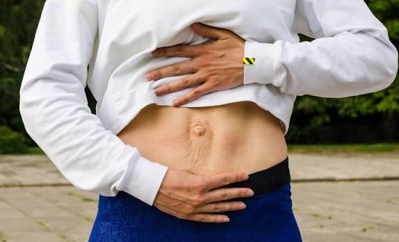 When Could Diastasis Recti Be the Missing Piece of the Puzzle Woburn Sands?